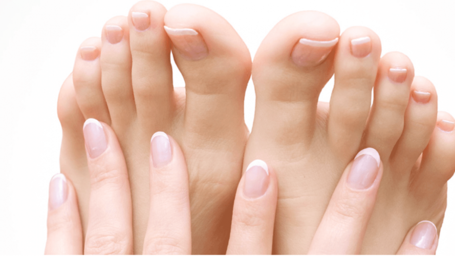 toenail laser treatment